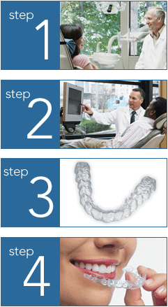 invisalign01 (1)