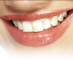 invisalign (1)